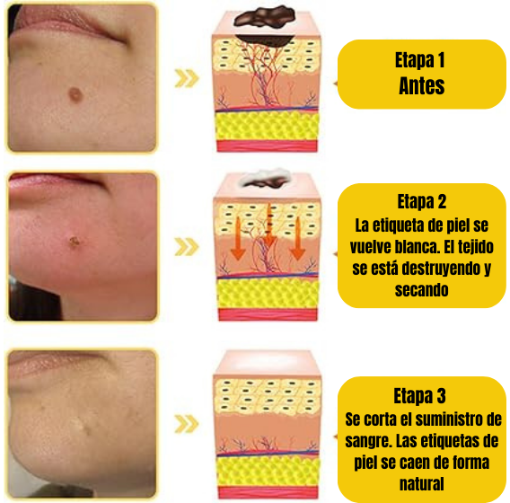 🐝✨ Bee Venom Treatment Cream